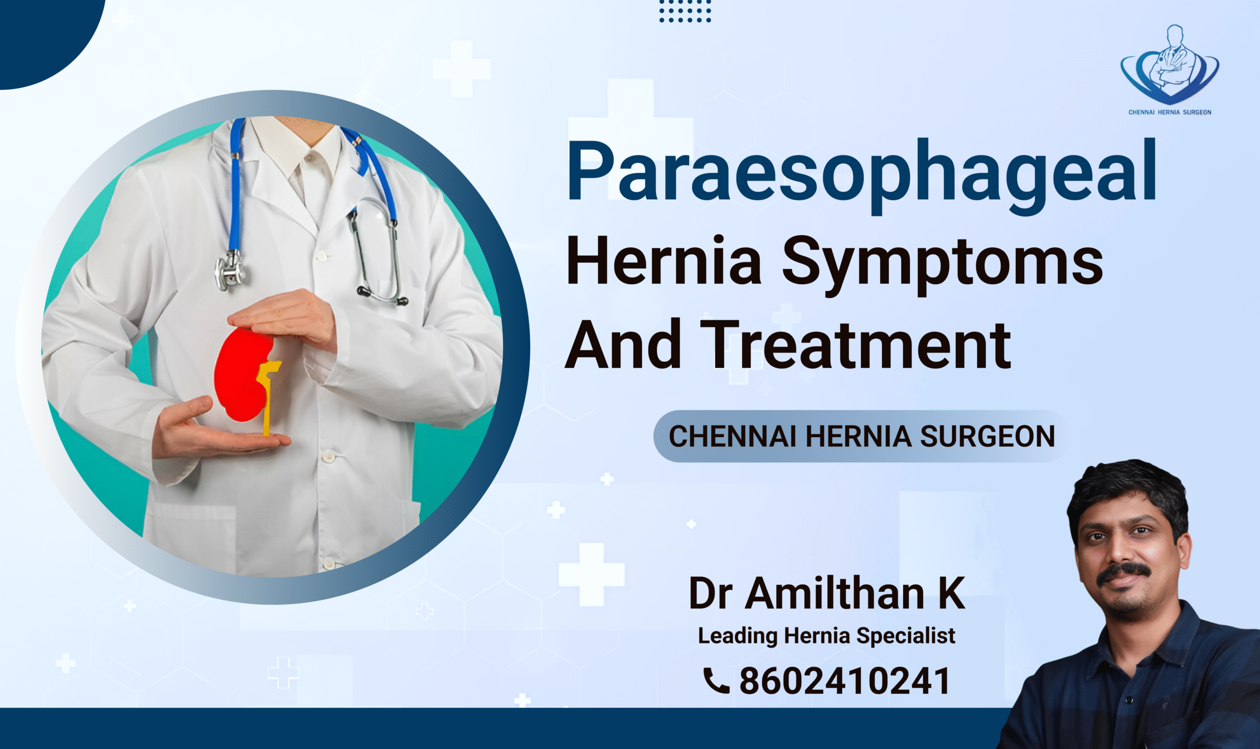 Paraesophageal Hernia Symptoms and Treatment